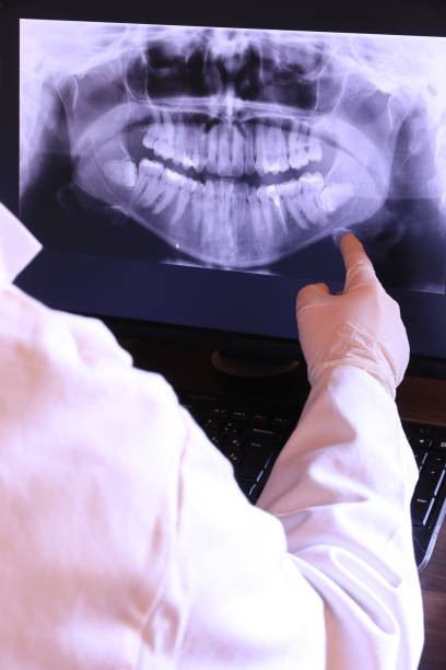 Best Emergency Dental Care for Broken or Chipped Teeth in Tainter Lake, WI