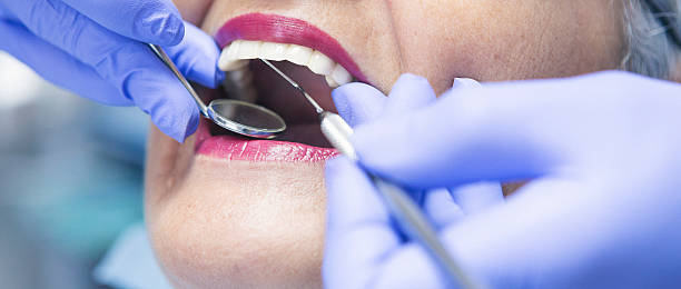 Best Emergency Wisdom Teeth Removal in Tainter Lake, WI